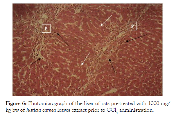 biochemistry-and-analytical-biochemistry-photomicrograph-liver