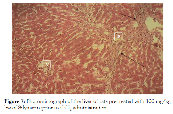 biochemistry-and-analytical-biochemistry-photomicrograph-liver