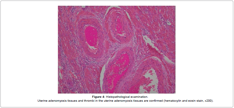 blood-disorders-transfusion-Histopathological