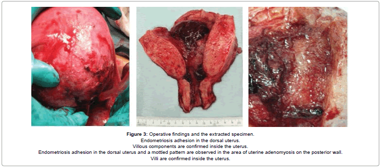 blood-disorders-transfusion-extracted-specimen