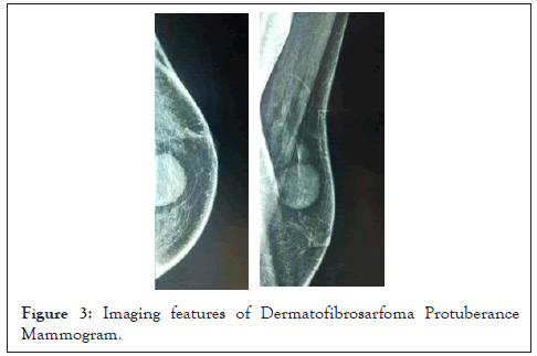 carcinogenesis-mutagenesis-Imaging-features