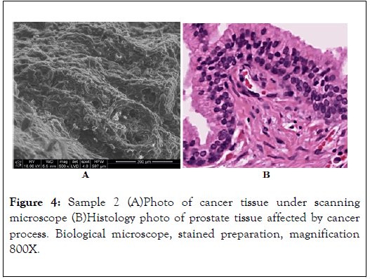 carcinogenesis-mutagenesis-cancer