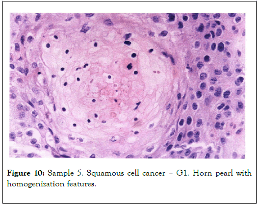 carcinogenesis-mutagenesis-homogenization