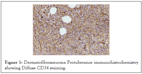 carcinogenesis-mutagenesis-immunohistochemistry