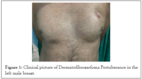 carcinogenesis-mutagenesis-male-breast