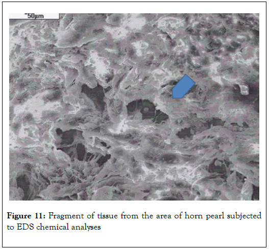 carcinogenesis-mutagenesis-tissue