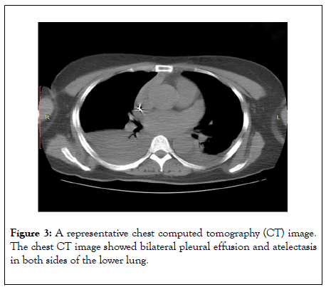 clinical-research-bioethics-chest