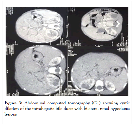 clinics-mother-abdominal