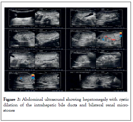 clinics-mother-abdominal-ultrasound