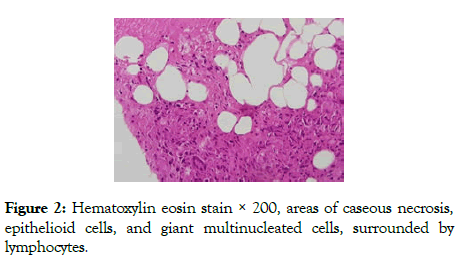 clinics-mother-child-health-multinucleated-cells