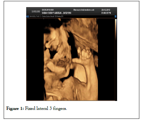 clinics-mother-fixed-lateral