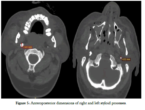 dentistry-Anteroposterior