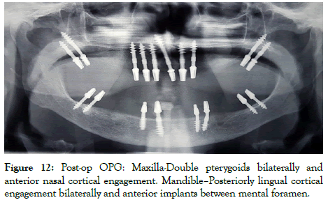 dentistry-anterior-nasal