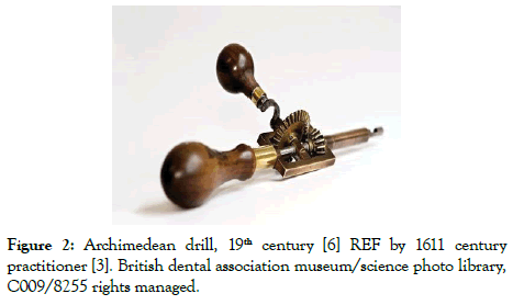 dentistry-archimedean-drill