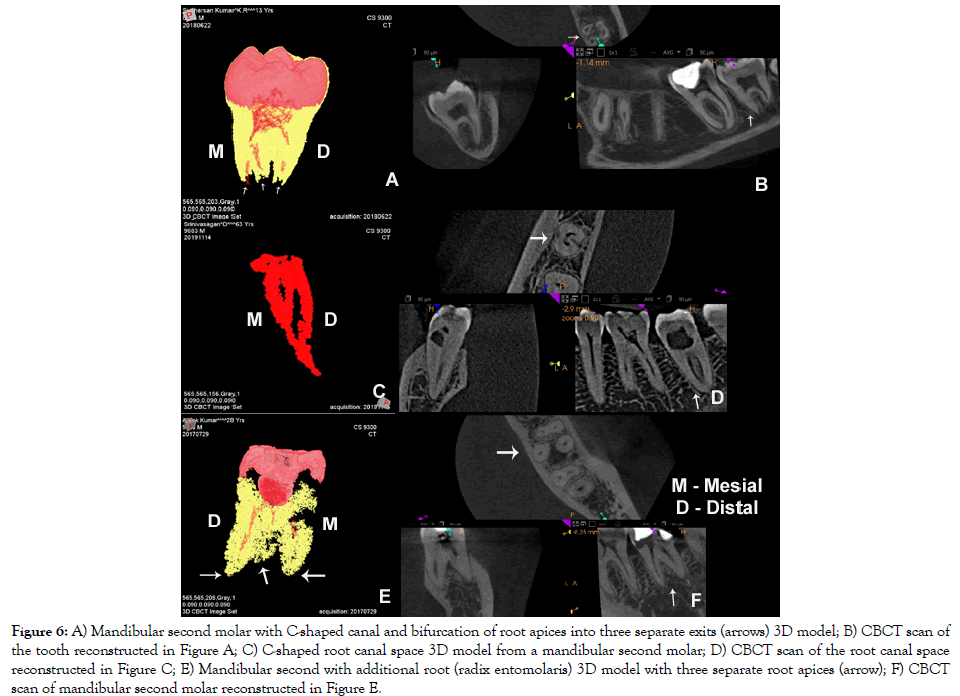 dentistry-bifurcation