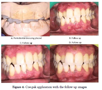 dentistry-coe-pak