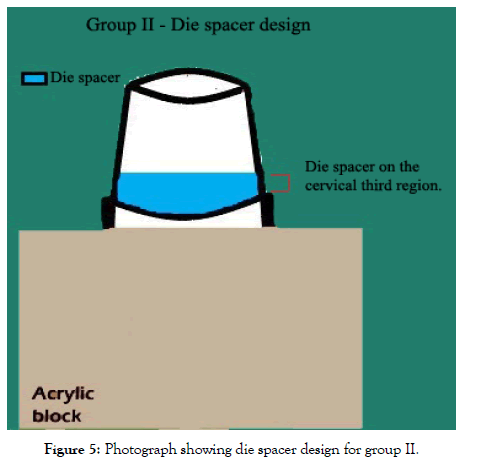 dentistry-die-spacer-design