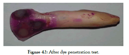 dentistry-dye