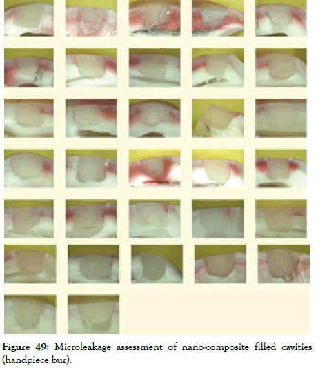 dentistry-filled-cavities