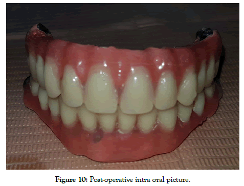 dentistry-intra-oral