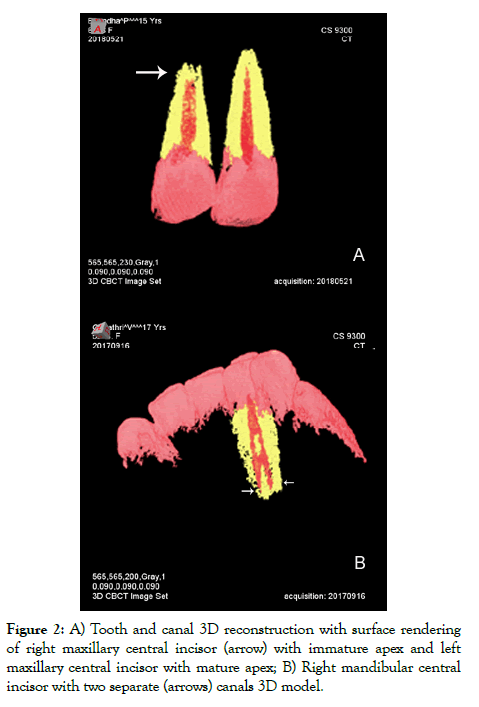 dentistry-maxillary