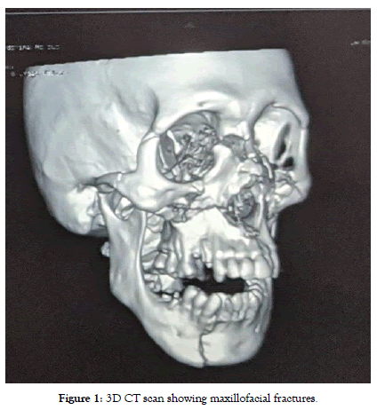 dentistry-maxillofacial