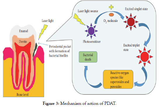 dentistry-mechanism