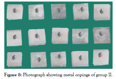 dentistry-metal-copings