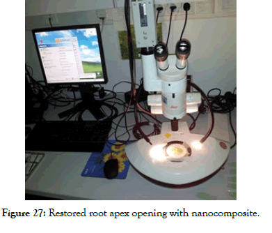 dentistry-nanocomposite