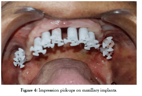 dentistry-pick-ups