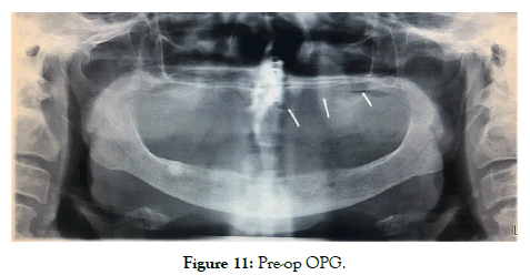 dentistry-pre-op-opg