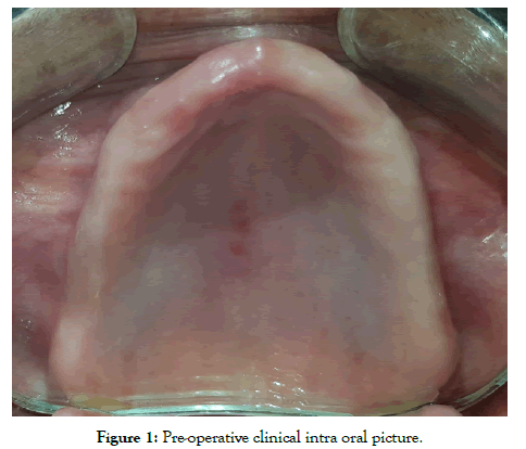 dentistry-pre-operative