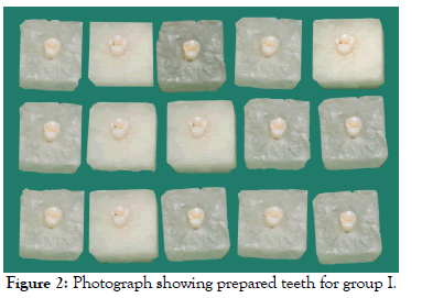 dentistry-prepared-teeth