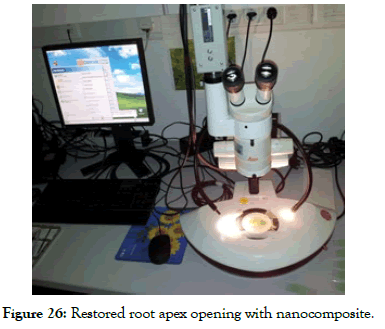 dentistry-restored-root