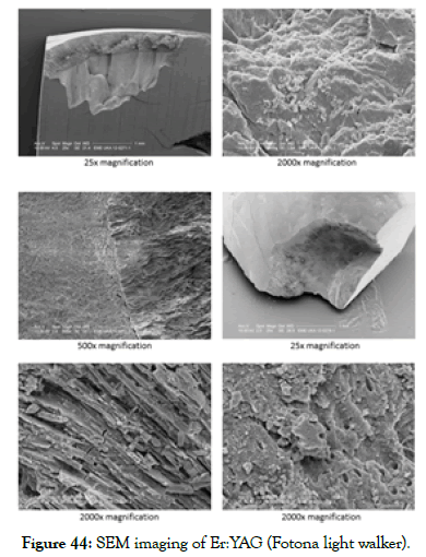 dentistry-sem-imaging