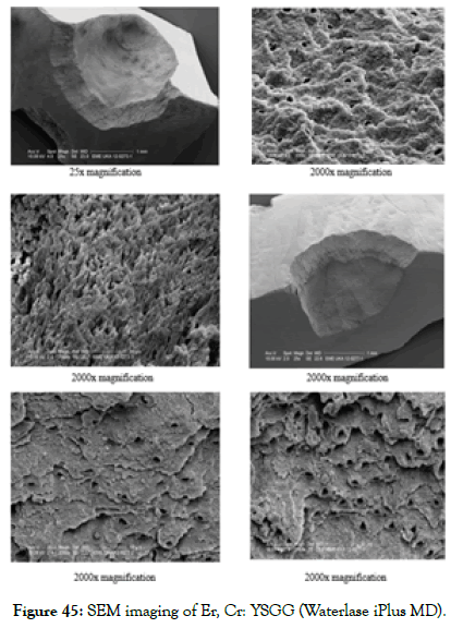 dentistry-sem-imaging-of-er