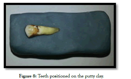 dentistry-teeth