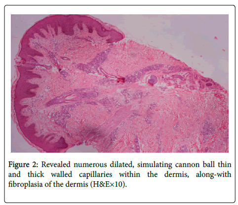 dermatitis-Revealed-numerous