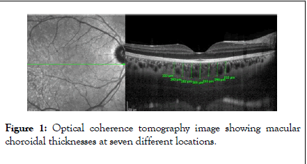 eye-diseases-and-disorders-tomography-image