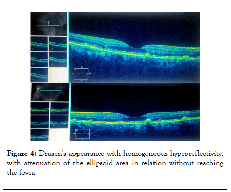 eye-diseases-disorders-appearance