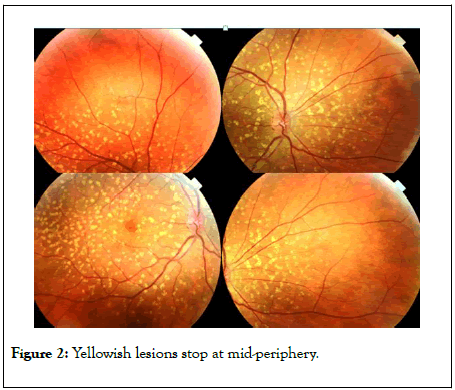 eye-diseases-disorders-lesions