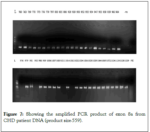 gene-technology-exon