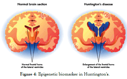 health-care-reviews-Huntington