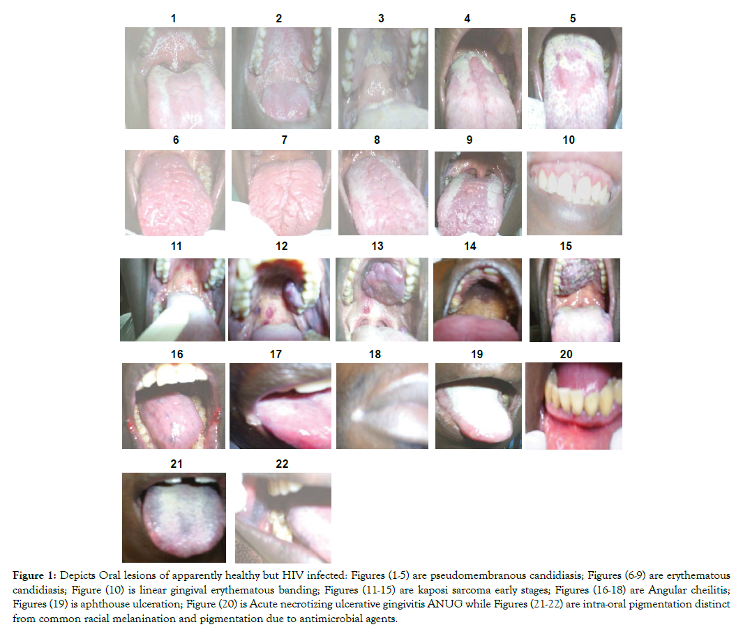 microbial-biochemical-technology-oral-lesions