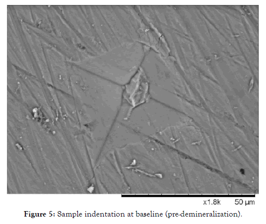 nanomedicine-nanotechnology-demineralization