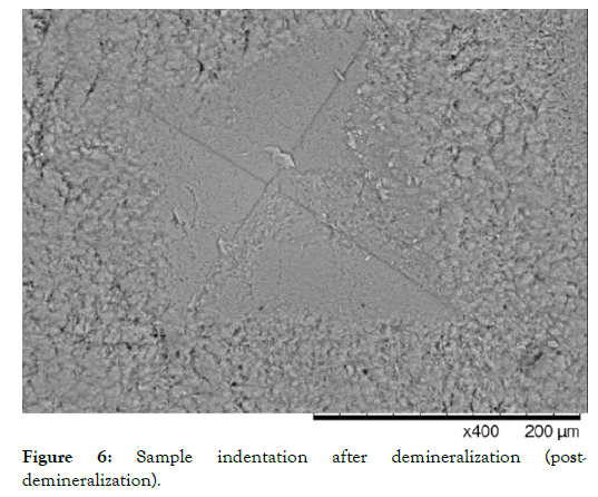 nanomedicine-nanotechnology-postdemineralization