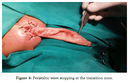 neonatal-biology-transition-zone