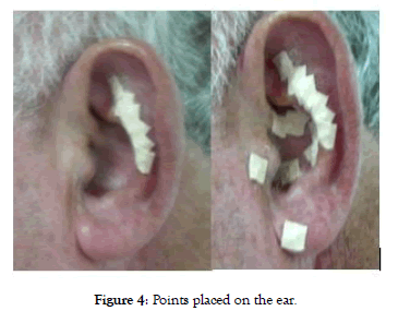 pain-management-medicine-placed