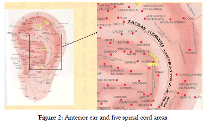 pain-management-medicine-spinal