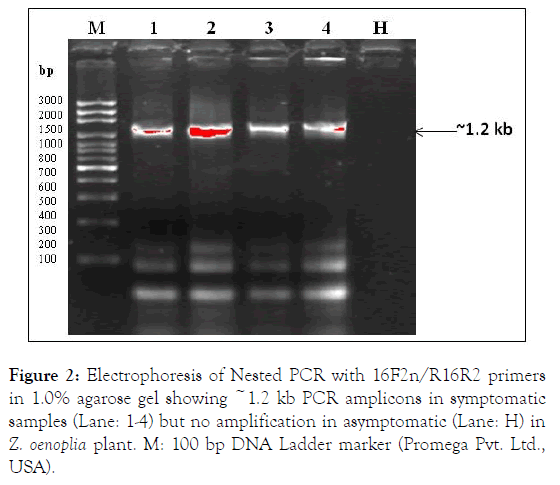 plant-pathology-microbiology-electrophoresis